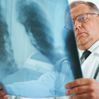 Doctor with X-ray