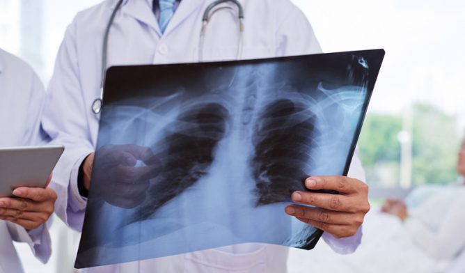 Doctors examining chest X-ray