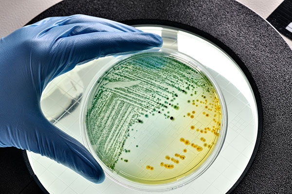 Modified E.Coli Used for Suicide Gene Therapy