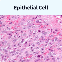 Epithelial cells