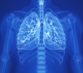 Glowing blue X-ray lungs