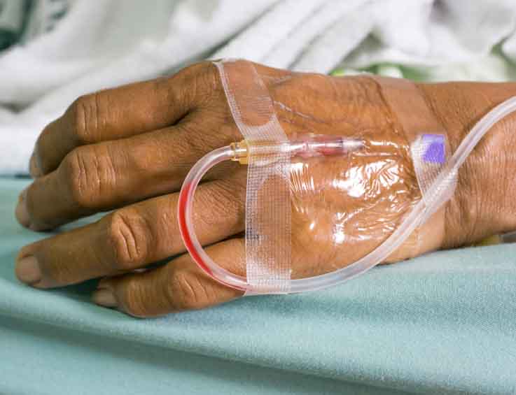 Hand of a old female patient with saline intravenous (IV) drip in Hand of a old female patient with saline intravenous (IV) drip in