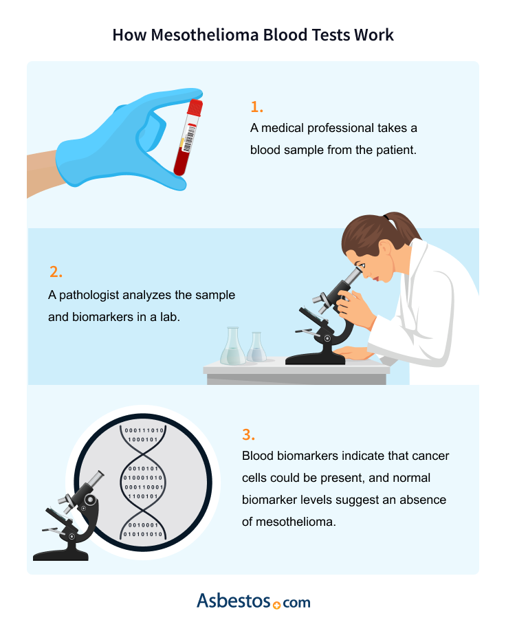 How Mesothelioma Blood Tests work