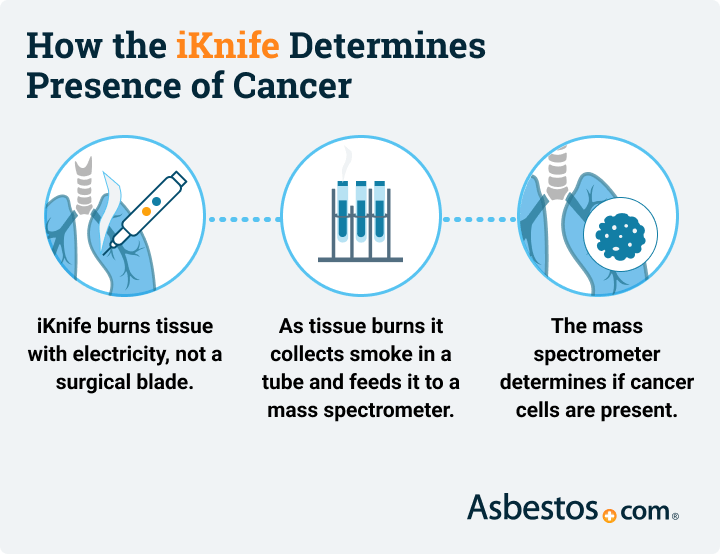 How the iKnife determines the presence of cancer