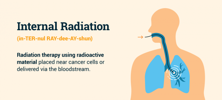 Internal radiation definition