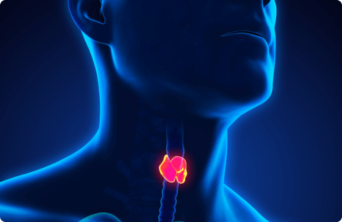 highlighted view of laryngeal cancer