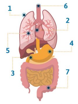 Late stages of mesothelioma symptoms