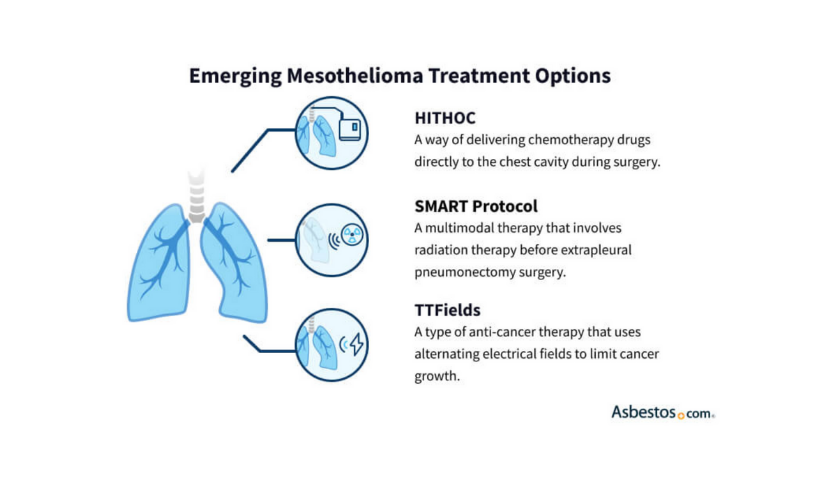 Crisp New Cure For Mesothelioma Through Surgery Design for Your Screen Crisp New Cure For Mesothelioma Through Surgery Design for Your Screen