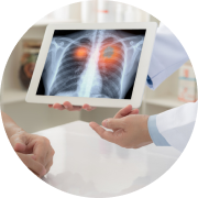 Doctor showing X-ray of lungs to patient