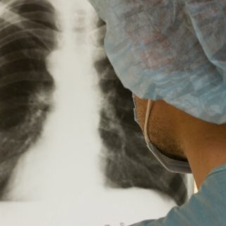 Masked technician looking at lung X-ray