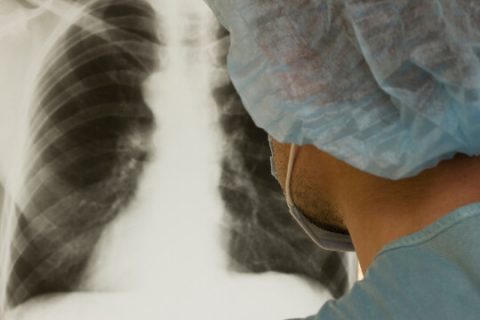 Masked technician looking at lung X-ray