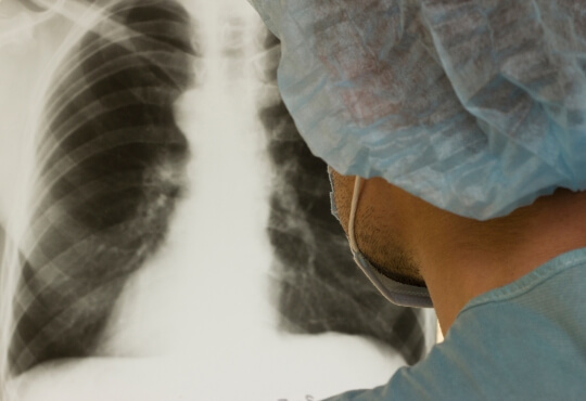 Masked technician looking at lung X-ray