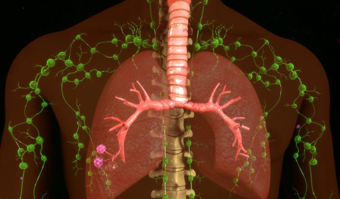 can asbestos cause kidney cancer