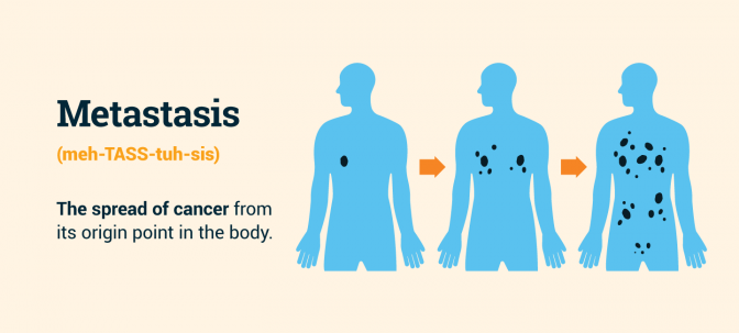 Metastasis definition