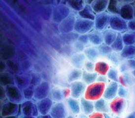 PDD Light Cancer Cells
