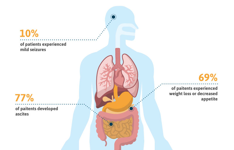 Mesothelioma Symptoms: Asbestos Cancer Warning Signs