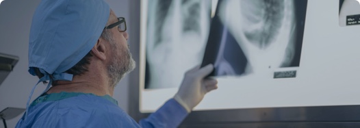 Doctor reviewing chest X-rays of a patient