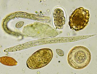 Pinworm parasite and eggs