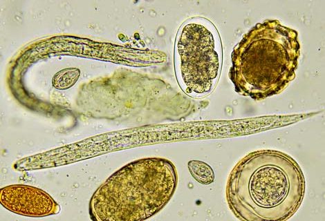Pinworm parasite and eggs