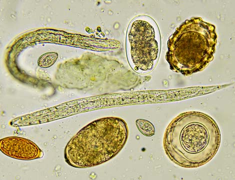 Pinworm parasite and eggs