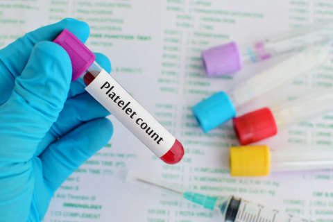 Test tube with platelet count label