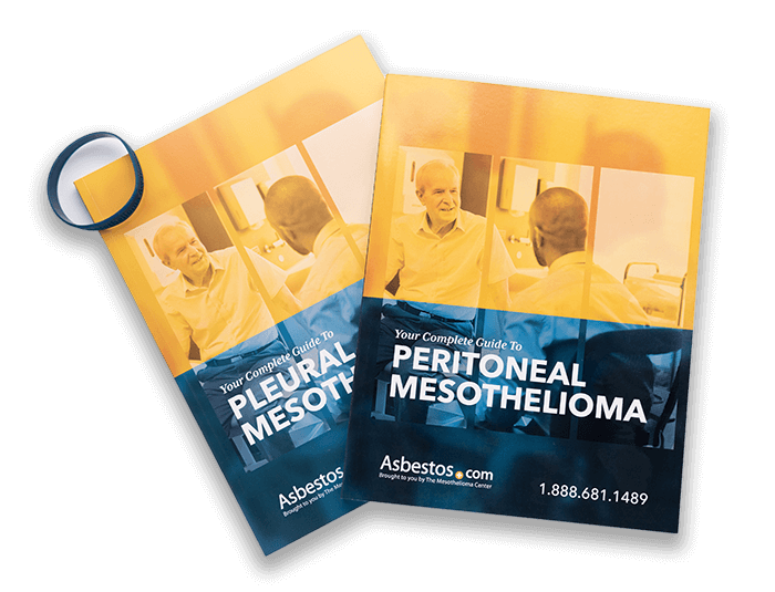 your complete guide to peritoneal mesothelioma