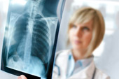 Doctor Examining X-Ray