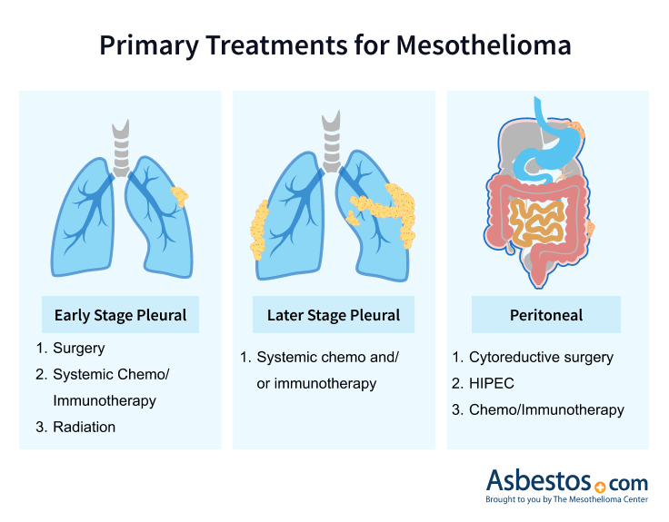 Picture of the body showing mesothelioma types and recommended treatments