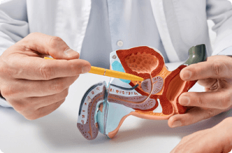 Prostate cancer consultation with doctor