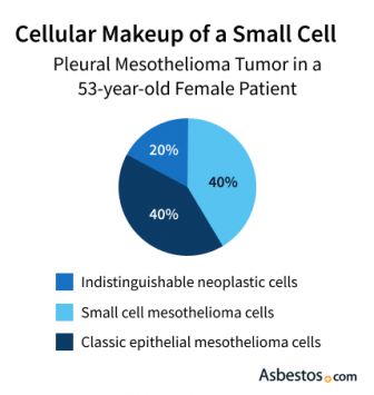 Cellular makeup of a small cell tumor