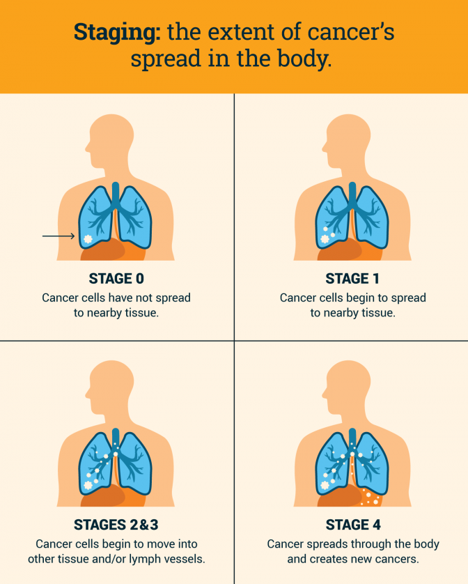 Staging definition and cancer spread by stage