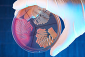Modified E.Coli Used for Suicide Gene Therapy