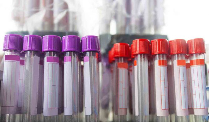 Test tubes in a rack