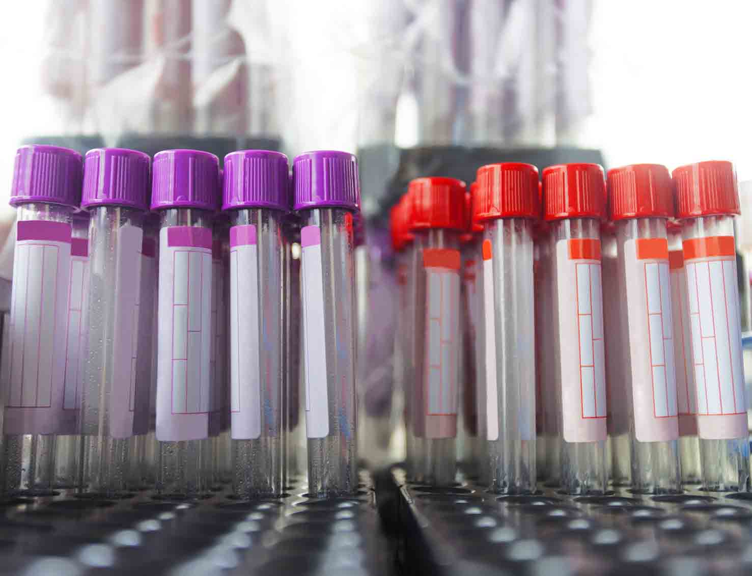 Test tubes in a rack Test tubes in a rack