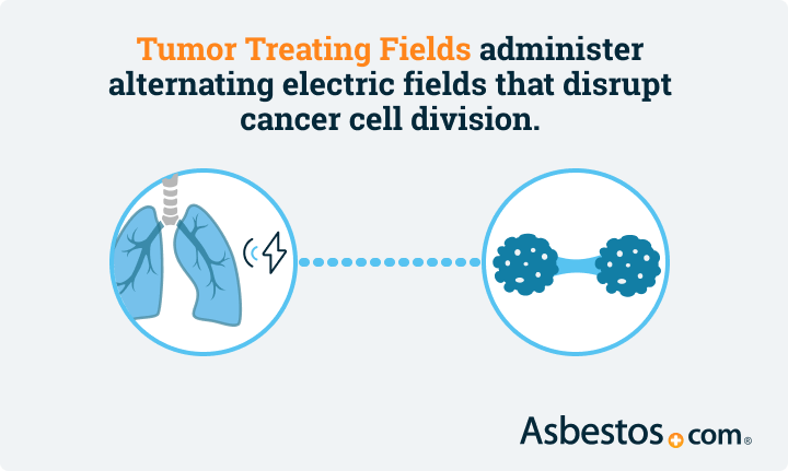 How Tumor Treating Fields works