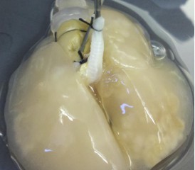 3-D lung model