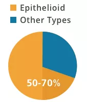 Epithelial mesothelioma distribution
