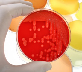 Petri dish with culture in red agar Petri dish with culture in red agar