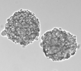 Lung cancer cells Lung cancer cells