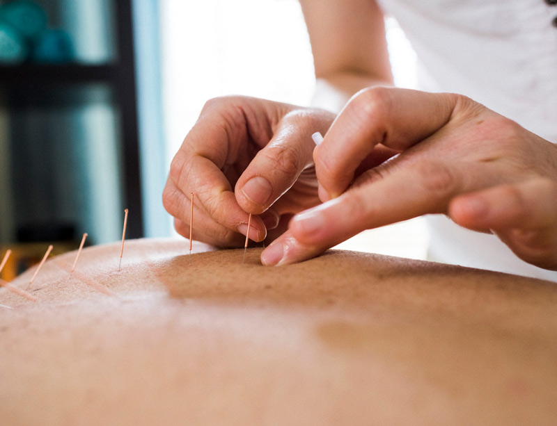 Acupuncture: Treating Mesothelioma Through Mind, Body & Spirit