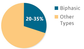 biphasic-graph Pie chart showing that 20-35% of mesothelioma cases are biphasic