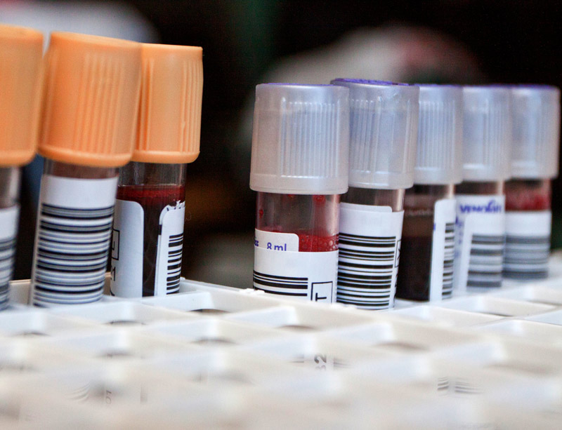 Blood samples in tubes Blood samples in tubes