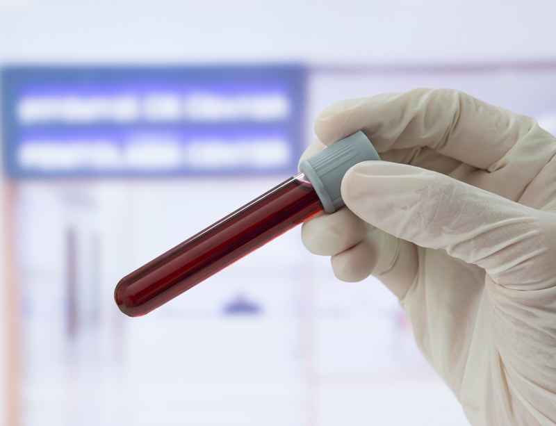 Blood sample Blood sample