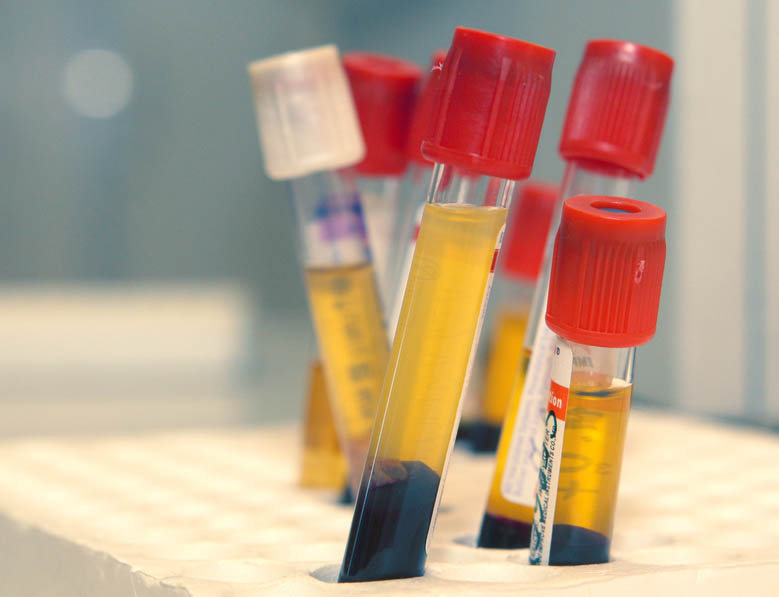 Test tubes with red cover stored in laboratory rack Test tubes with red cover stored in laboratory rack