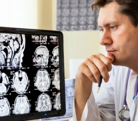 Doctor examines brain scan Doctor examines brain scan