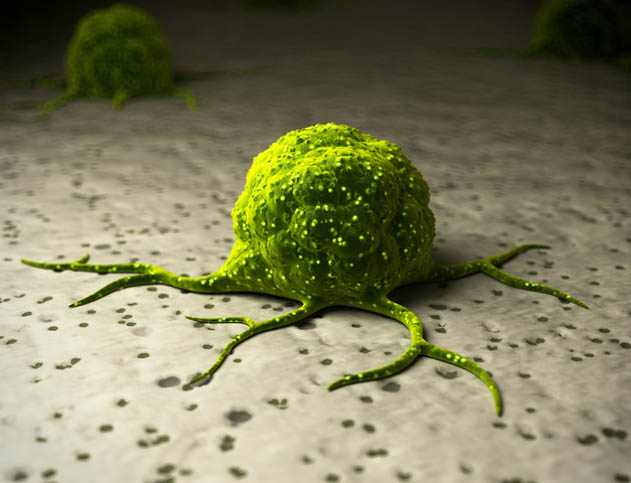 cancer cell tumor cancer cell tumor
