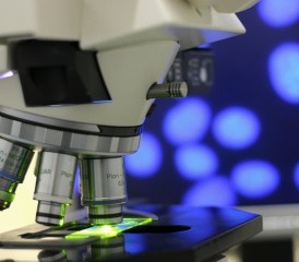 Microscope Looking at Cancer Cells Microscope Looking at Cancer Cells