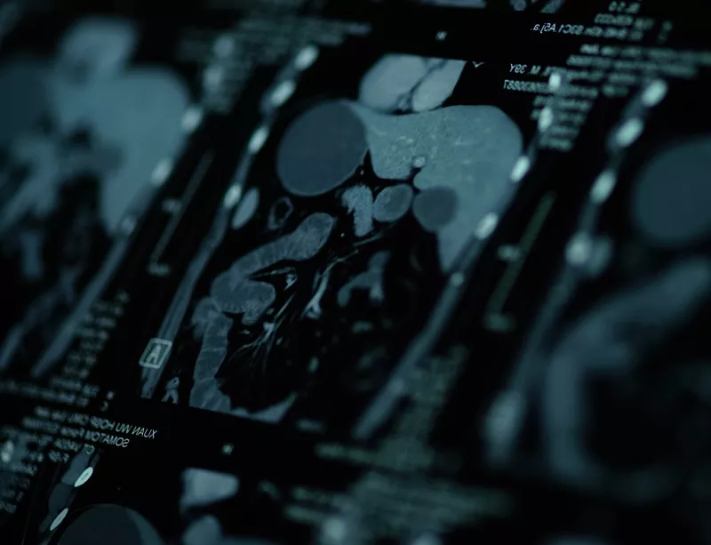 CT Scanning CT Scanning