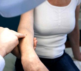 Woman with melanoma symptom on her arm Woman with melanoma symptom on her arm