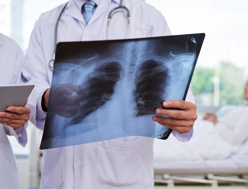 Doctors examining chest X-ray Doctors examining chest X-ray